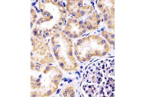 (ABIN6242389 and ABIN6578670) staining Hsp60 in human kidney tissue sections by Immunohistochemistry (IHC-P - paraformaldehyde-fixed, paraffin-embedded sections). (HSPD1 anticorps  (AA 340-374))