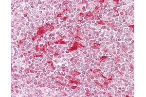 Anti-ETV5 antibody IHC of human spleen.