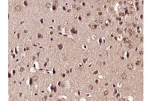 Paraformaldehyde-fixed, paraffin embedded mouse brain tissue, Antigen retrieval by boiling in sodium citrate buffer (pH6.
