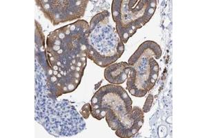 Immunohistochemical staining of human colon with JAKMIP3 polyclonal antibody  shows moderate cytoplasmic and membranous positivity in glandular cells at 1:50-1:200 dilution. (JAKMIP3 anticorps)