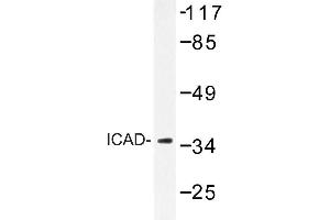 Image no. 1 for anti-DNA Fragmentation Factor, 45kDa, alpha Polypeptide (DFFA) antibody (ABIN272297) (DFFA anticorps)
