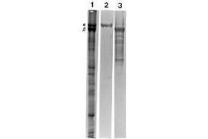 Western blotting polypeptides of ghosts of human erythrocytes (Lane 1, total protein profile) and reaction with MAb AF10 (Erythroid a-Spectrin)(Lane 2) and MAb DB2 (Erythroid b-Spectrin) (SPTA1 anticorps)