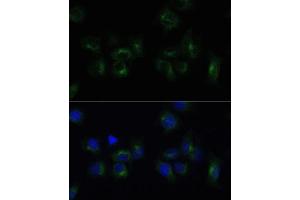 Immunofluorescence analysis of HeLa cells using CLTB Polyclonal Antibody (ABIN6131587, ABIN6138750, ABIN6138751 and ABIN6224454) at dilution of 1:100 (40x lens). (CLTB anticorps  (AA 1-211))