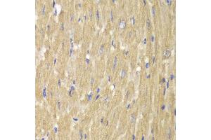 Immunohistochemistry of paraffin-embedded mouse heart using NCF2 antibody at dilution of 1:100 (400x lens). (NCF2 anticorps)