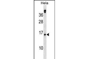 SLPI Antibody (Center) (ABIN1538516 and ABIN2848668) western blot analysis in Hela cell line lysates (35 μg/lane). (SLPI anticorps  (AA 59-88))
