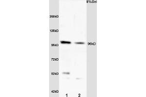 L1 rat heart lysate L2 rat kidney lysates probed with Anti VLDL Polyclonal Antibody, Unconjugated (ABIN705551) at 1:200 overnight at 4 °C. (VLDLR anticorps  (AA 551-650))