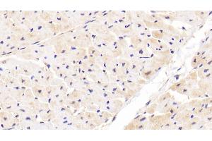 Detection of IkBe in Human Cardiac Muscle Tissue using Polyclonal Antibody to Inhibitory Subunit Of NF Kappa B Epsilon (IkBe)