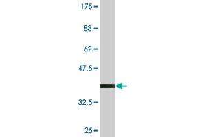 Western Blot detection against Immunogen (36. (ZNF396 anticorps  (AA 131-230))