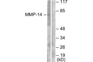 Western Blotting (WB) image for anti-Matrix Metallopeptidase 14 (Membrane-inserted) (MMP14) (C-Term) antibody (ABIN1848674) (MMP14 anticorps  (C-Term))