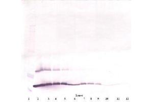Image no. 2 for anti-Thymic Stromal Lymphopoietin (TSLP) antibody (ABIN465621) (Thymic Stromal Lymphopoietin anticorps)
