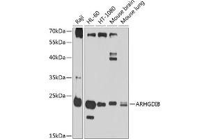 Western blot analysis of extracts of various cell lines, using ARHGDIB antibody (ABIN1678741, ABIN3018028, ABIN3018029 and ABIN6220341) at 1:1000 dilution. (ARHGDIB anticorps  (AA 1-201))