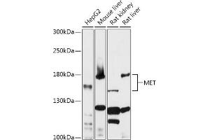 Western blot analysis of extracts of various cell lines, using MET antibody (ABIN1513199, ABIN5663553, ABIN5663555 and ABIN6213594) at 1:1000 dilution. (c-MET anticorps  (AA 25-325))