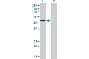 Western Blot analysis of STK38 expression in transfected 293T cell line by STK38 monoclonal antibody (M04), clone 2F3.