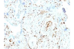 Formalin-fixed, paraffin-embedded human Placenta stained with S100A2 Mouse Monoclonal Antibody (CPTC-S100A2-2).