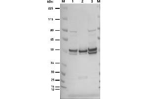 Western blot: anti-NucleoproteinM: M: Marker 1: (ABIN7538787) VLP_SARS-CoV-2 (M+E+N) 2: SARS-CoV-2 nucleoprotein (Sino Biologicals 40588-V08B) 3: (ABIN7538786) VLP_SARS-CoV-2 (S+M+E+N) 1°Antibody: monoclonal rabbit anti-nucleoprotein (Sino Biological 40143-R019) 1:2500 2°Antibody: Goat-anti-Rabbit-HRP