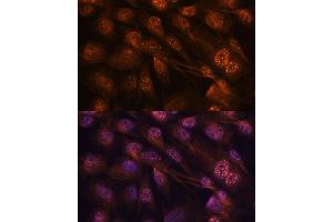 Immunofluorescence analysis of C6 cells using MEK7 antibody (ABIN3023156, ABIN3023157, ABIN3023158 and ABIN6219416) at dilution of 1:100.