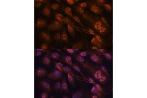 Immunofluorescence analysis of C6 cells using MEK7 antibody (ABIN3023156, ABIN3023157, ABIN3023158 and ABIN6219416) at dilution of 1:100. (MAP2K7 anticorps  (AA 1-250))