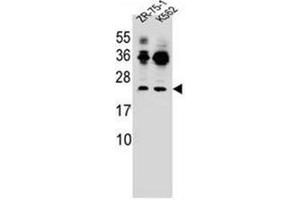 Western blot analysis of FRAT2 Antibody (C-term) in ZR-75-1,K562 cell line lysates (35ug/lane).