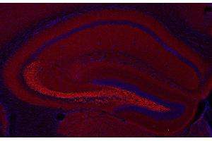 Indirect immunostaining of a PFA fixed mouse hippocampus section (dilution 1 : 200; red).