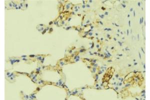 ABIN6277672 at 1/100 staining Mouse lung tissue by IHC-P. (ECE1 anticorps  (N-Term))