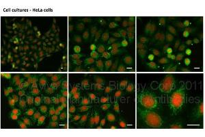 Sample Type :  Eye tissue (ZEB1 anticorps  (N-Term))
