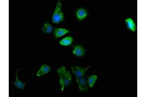 Immunofluorescence staining of MCF-7 cells with ABIN7173988 at 1:100, counter-stained with DAPI.