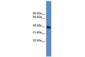WB Suggested Anti-UBLCP1 Antibody Titration: 0. (UBLCP1 anticorps  (N-Term))