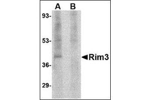 Western blot analysis of Rim3 in human brain tissue lysate with this product at 1 μg/ml in the (A) absence and (B) presence of blocking peptide. (RIMS3 anticorps  (N-Term))