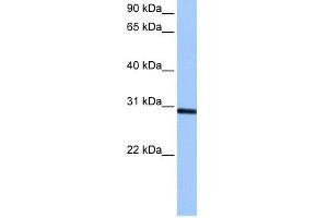WB Suggested Anti-ASB11 Antibody Titration: 0. (ASB11 anticorps  (C-Term))