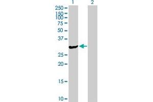 Western Blot analysis of ASB9 expression in transfected 293T cell line by ASB9 MaxPab polyclonal antibody.