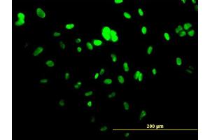 Immunofluorescence of monoclonal antibody to UBTF on HepG2 cell.