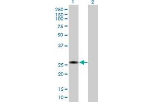 Western Blot analysis of RGS2 expression in transfected 293T cell line by RGS2 MaxPab polyclonal antibody. (RGS2 anticorps  (AA 1-211))