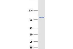 Validation with Western Blot