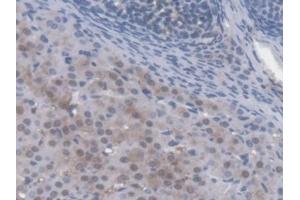 Detection of AMFR in Mouse Ovary Tissue using Polyclonal Antibody to Autocrine Motility Factor Receptor (AMFR)