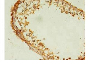 Immunohistochemistry of paraffin-embedded human testis tissue using ABIN7171437 at dilution of 1:100
