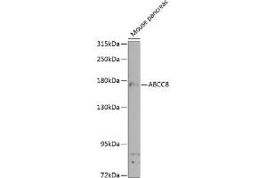 Western blot analysis of extracts of mouse pancreas, using  antibody (ABIN6129856, ABIN6136367, ABIN6136368 and ABIN6224521) at 1:1000 dilution. (ABCC8 anticorps  (AA 700-1000))