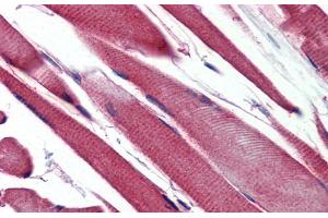 Immunohistochemistry with Human Skeletal Muscle lysate tissue at an antibody concentration of 5.