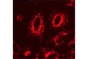 Lamp1 (Ly1C6), IF in transfected HeLa cells  Courtesy of Robert H Edwards, U of Cali, San Fran School of Medicine. (LAMP1 anticorps)