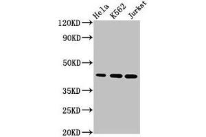 Western Blot Positive WB detected in: Hela whole cell lysate, K562 whole cell lysate, Jurkat whole cell lysate All lanes: PHF6 antibody at 2. (PHF6 anticorps  (AA 2-312))