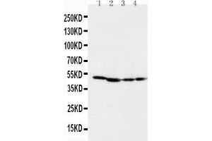 Anti-MEK1 antibody, Western blotting Lane 1: Rat Skeletal Muscle Tissue Lysate Lane 2: Rat Kidney Tissue Lysate Lane 3: CEM Cell Lysate Lane 4: COLO20 Cell Lysate (MEK1 anticorps  (C-Term))