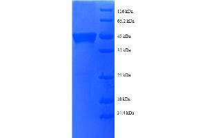 SDS-PAGE (SDS) image for Basic Transcription Factor 3 (BTF3) (AA 48-206), (partial) protein (GST tag) (ABIN5712181)