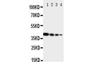 Lane 4: Recombinant Human ERRB4 Protein 1. (ERBB4 anticorps  (N-Term))