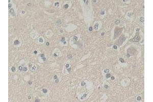 Detection of ABI1 in Human Cerebrum Tissue using Polyclonal Antibody to Abl Interactor 1 (ABI1)