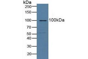 Detection of NCL in Human Lung Tissue using Polyclonal Antibody to Nucleolin (NCL)