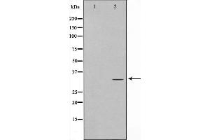 Western blot analysis on Jurkat cell lysate using ELOVL1 Antibody，The lane on the left is treated with the antigen-specific peptide. (ELOVL1 anticorps  (Internal Region))