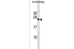 FGF20 Antibody (C-term) (ABIN1536710 and ABIN2838307) western blot analysis in mouse kidney tissue lysates (35 μg/lane).