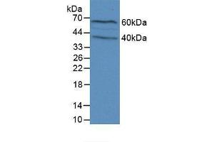 Western blot analysis of Mouse Brain Tissue. (Filaggrin anticorps  (AA 119-336))