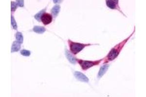 Anti-EDNRB antibody immunocytochemistry (ICC) staining of HEK293 human embryonic kidney cells transfected with EDNRB.