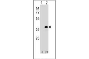 Image no. 2 for anti-Aldo-Keto Reductase Family 1, Member B1 (Aldose Reductase) (AKR1B1) (AA 287-316), (C-Term) antibody (ABIN357880) (AKR1B1 anticorps  (C-Term))