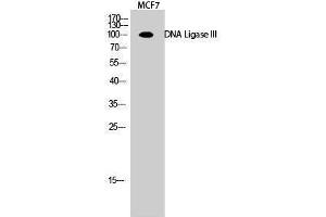 Western Blotting (WB) image for anti-Ligase III, DNA, ATP-Dependent (LIG3) (Internal Region) antibody (ABIN3184322) (LIG3 anticorps  (Internal Region))